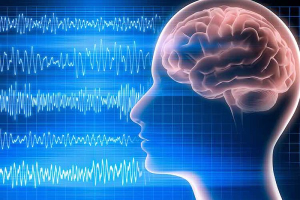 Điện não đồ là gì và tất tần tật những kiến thức liên quan